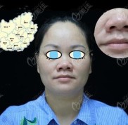 盤點(diǎn)南寧整形醫(yī)院排行前十名的醫(yī)院