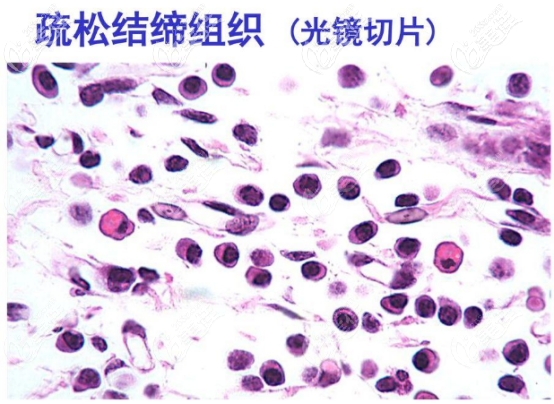 內切去眼袋是有風險的