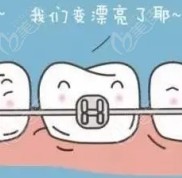 南寧牙博士收費(fèi)價(jià)目表