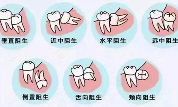 保山口腔医院收费标准来啦