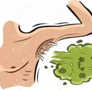 運城治療狐臭好的醫(yī)院有哪些