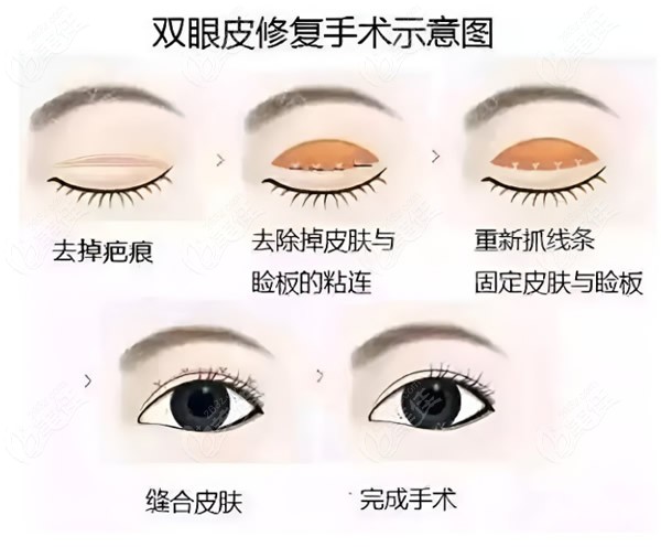 上海修复眼睛比较好的医生是杜园园/杨亚益和许炎龙等10位