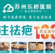 除了蘇州樂(lè)橋這家疤痕專(zhuān)科外