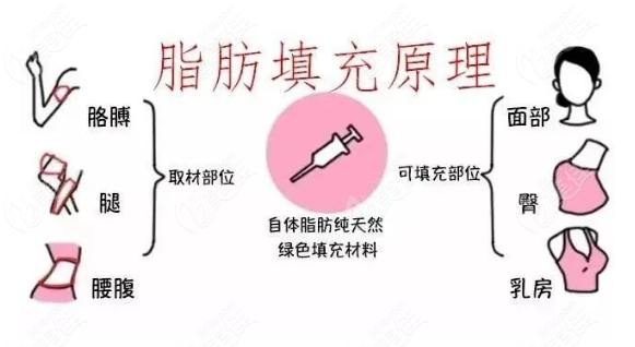 面部凹陷怎么改善