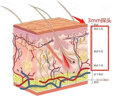 5gmax極速提拉和半島超聲泡哪個(gè)好