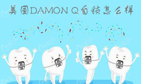 美國damon q自鎖怎么樣