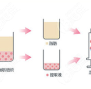 比一比北京八大處脂肪填充誰(shuí)做得好