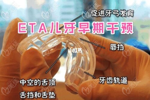 eta牙齿矫正替牙期牙列不齐多少钱