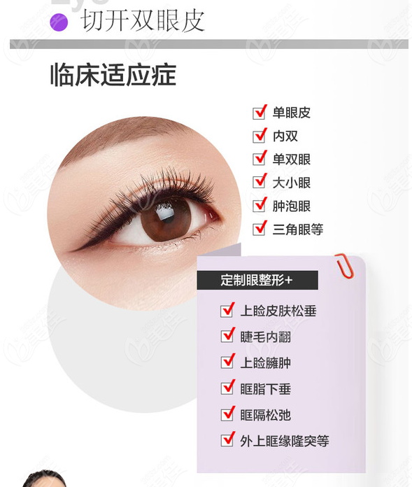 找抚州江医生医疗美容门诊部的江娟萍院长割双眼皮需要多少钱