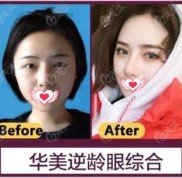 邯鄲華美做眼綜合怎么樣