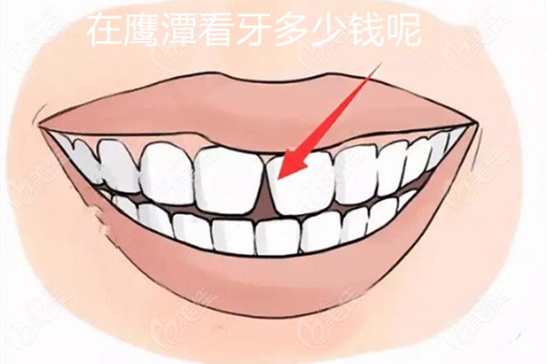 鷹潭牙科醫(yī)院收費(fèi)價目表中