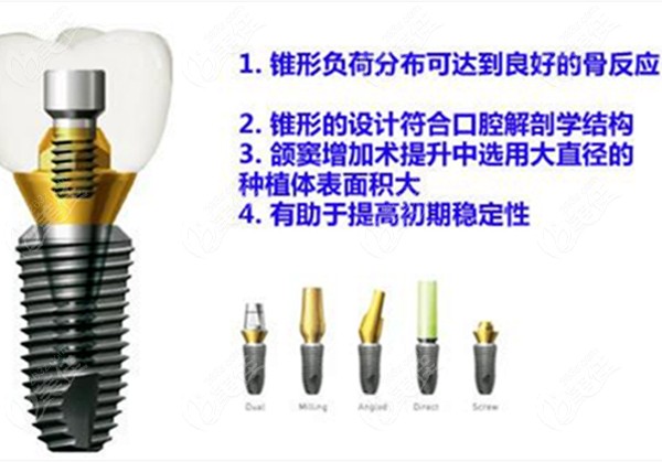 韩国登腾种植牙适合年轻人吗