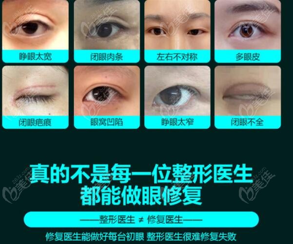 北京双眼皮修复比较好的三位医生技术比拼