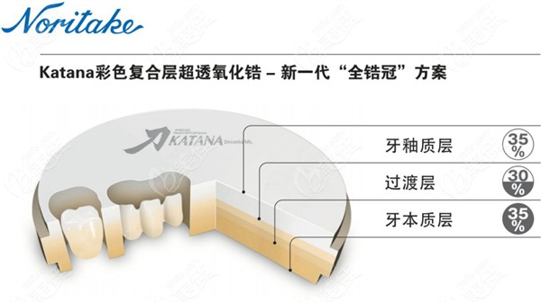 日本則武-卡塔納彩色氧化鋯全瓷牙系列