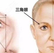 沈陽(yáng)做提眉手術(shù)好的十大整形醫(yī)院名單公布