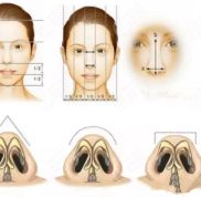 邯鄲華美醫(yī)療美容醫(yī)院鼻綜合整形好嗎