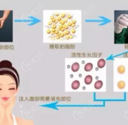 重慶華美脂肪填充醫(yī)生名單請(qǐng)過(guò)目