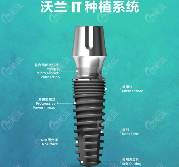 沃蘭植體是韓國的還是瑞士的