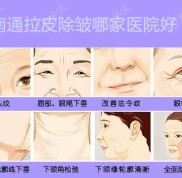 南通拉皮除皺哪家醫(yī)院好
