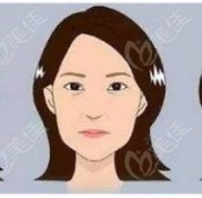運(yùn)城做小拉皮手術(shù)好的醫(yī)院有華美