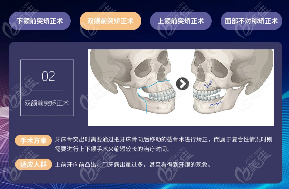 全国较好正颌手术医院排名