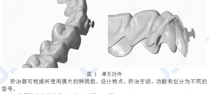 隱形牙套矯正受力原理是什么