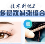 濟(jì)南眼綜合哪家醫(yī)院好