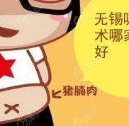 無錫吸脂手術(shù)哪家醫(yī)院好