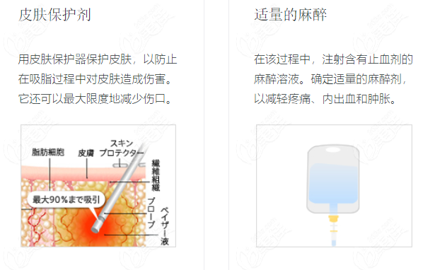 去日本整容—般多少錢