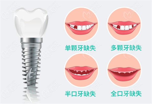 慈溪口腔醫(yī)院收費(fèi)價(jià)目表