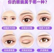 大同做全切雙眼皮修復(fù)醫(yī)院哪家好