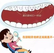 邵陽矯正牙齒多少錢