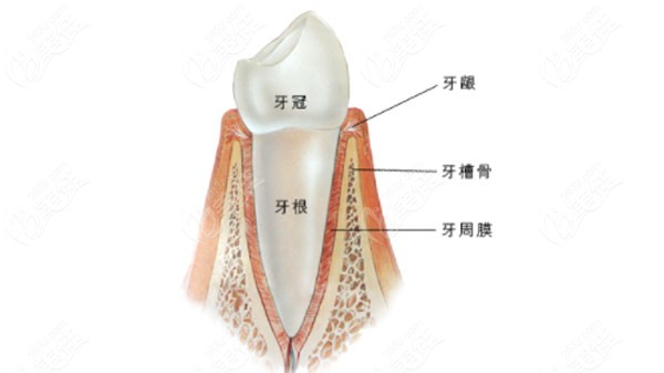 根管治療后的烤瓷牙牙根斷了怎么處理好 