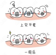 婁底口腔醫(yī)院牙齒矯正多少錢
