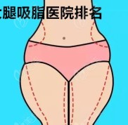 蘇州大腿吸脂醫(yī)院排名已更新