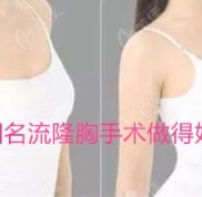 沈陽名流隆胸手術(shù)做得好嗎