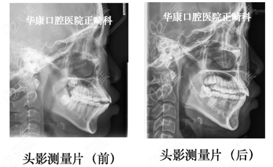 金华整牙哪里便宜又好