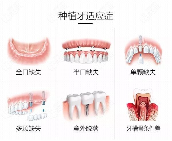 石嘴山口腔医院收费标准已发布