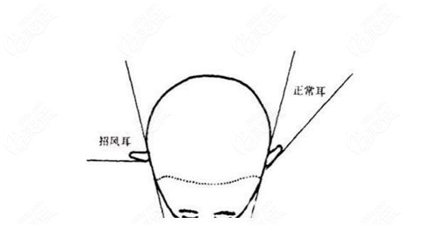 成都耳朵整形医院哪家好