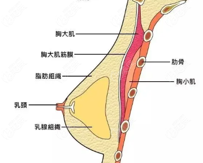 果凍胸做下得多少錢