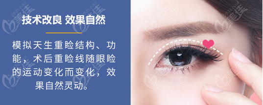 深圳王志东医生的双眼皮技术很靠谱哦