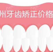 泰州牙齒矯正多少錢