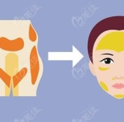 西寧做脂肪填充的醫(yī)院醫(yī)生名單公布