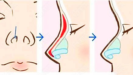 了解韓士生科105、205、214和215的區(qū)別后