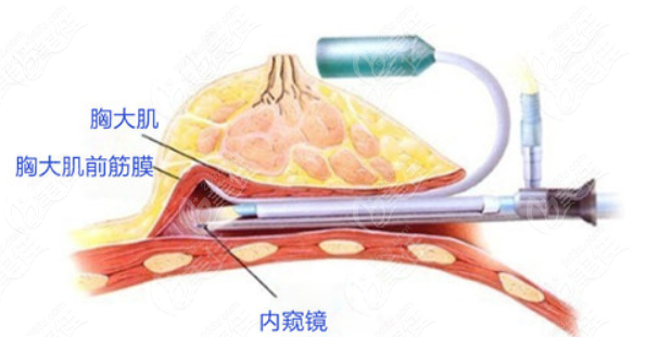 烟台隆胸整形医院排名公布