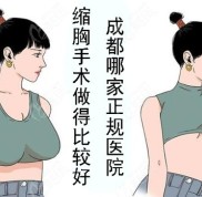 成都哪家正規(guī)醫(yī)院縮胸手術(shù)做得比較好