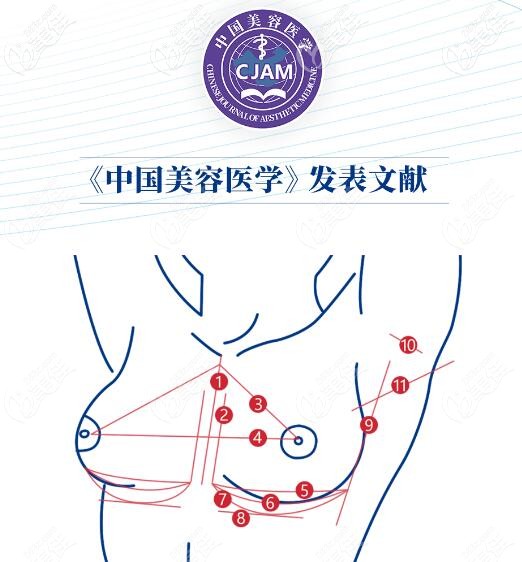 深圳富华唐新辉隆胸技术挺靠谱