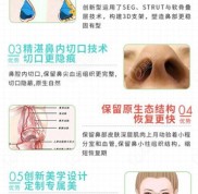 銀川做鼻子好的醫(yī)生都是