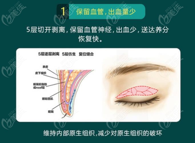 太原军大整形医院做双眼皮手术怎么样