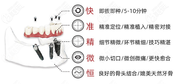 种植牙手术有几种方式